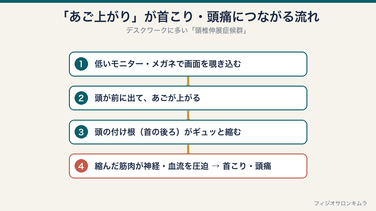 あご上がりが首こり・頭痛につながる流れの図：低いモニターやメガネで画面を覗き込む、頭が前に出てあごが上がる、頭の付け根が縮む、神経・血流を圧迫して首こり・頭痛