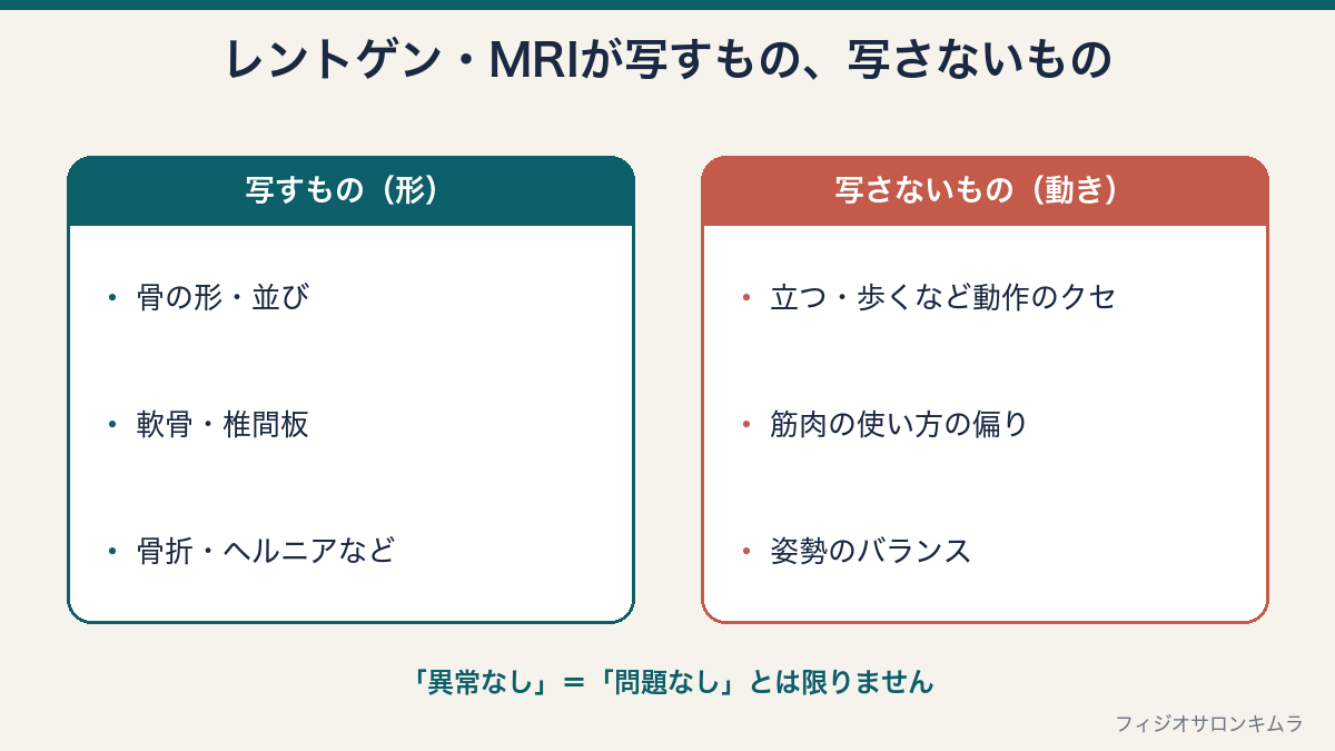 レントゲン・MRIが写すもの(骨の形・軟骨・骨折など)と写さないもの(動作のクセ・筋肉の使い方・姿勢のバランス)の比較図