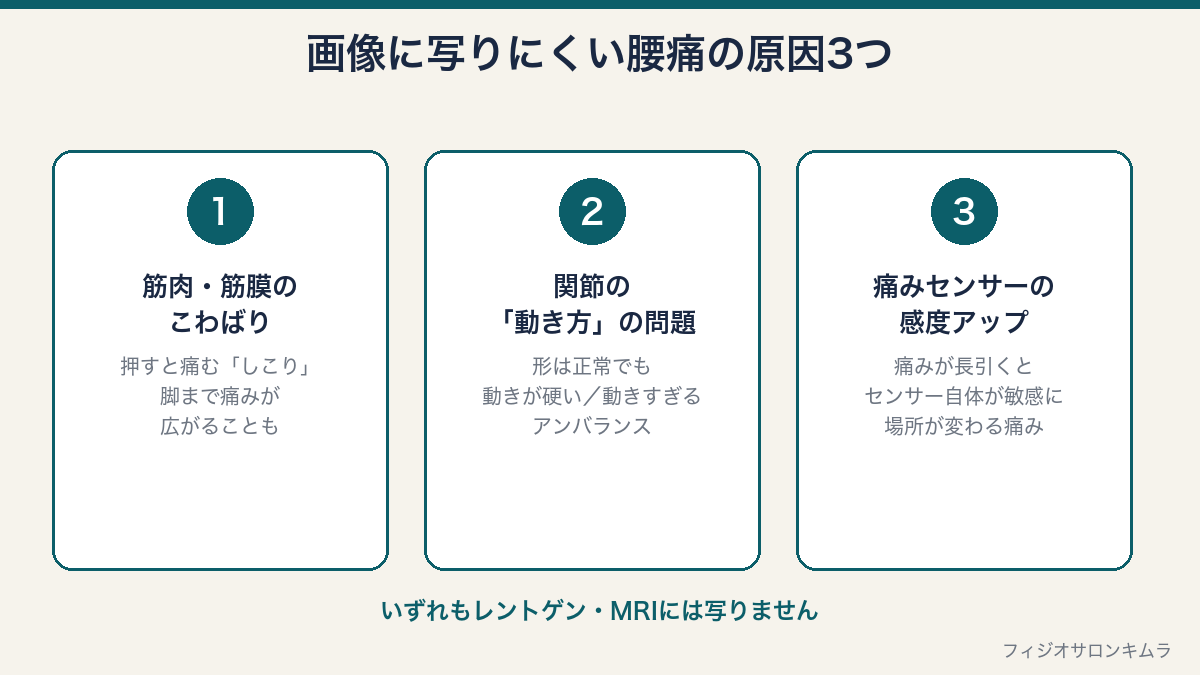 画像に写りにくい腰痛の3つの原因の図解：筋肉・筋膜のこわばり、関節の動き方の問題、痛みセンサーの感度アップ